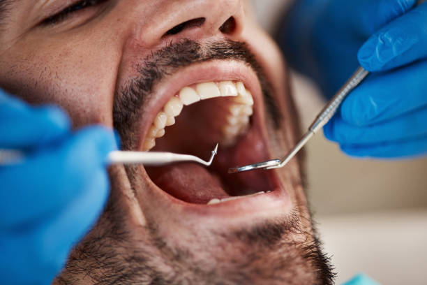 Best Mobile Emergency Dentist in Lebanon, IN